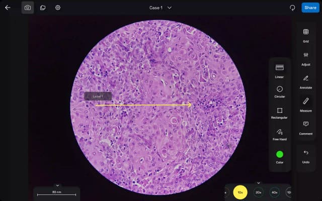 Annotate & Label Findings