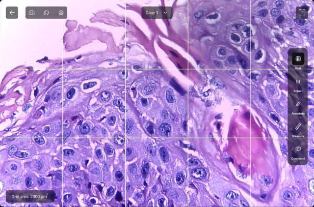Count Cells with Grids