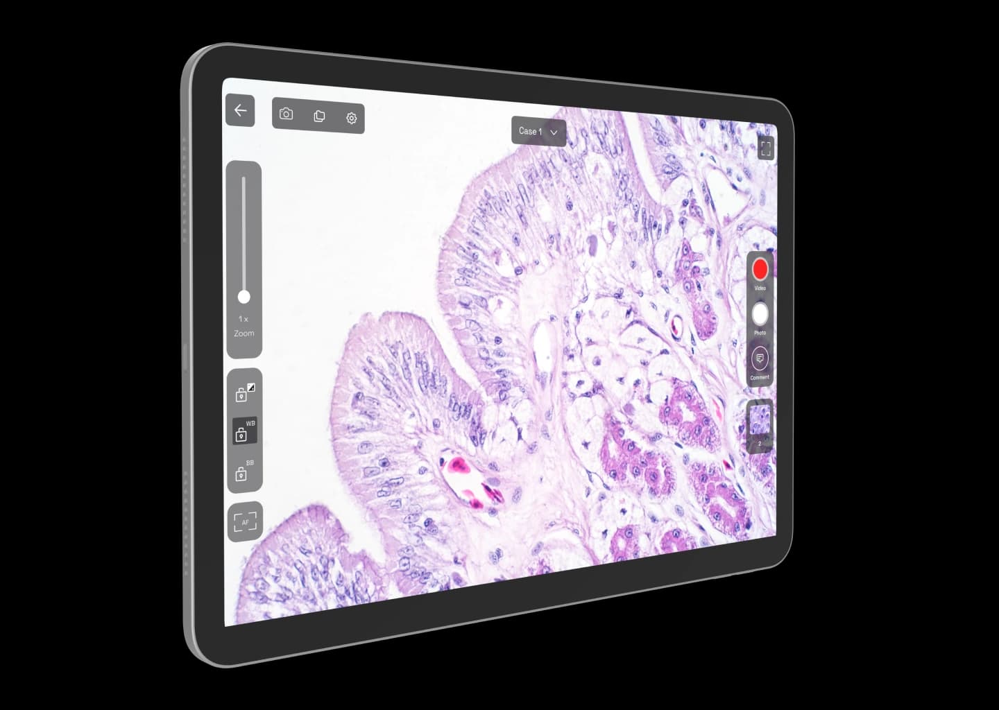 Tablet